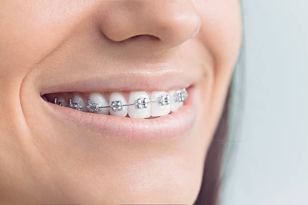 Best Veneers and Lumineers  in Brownstown, PA